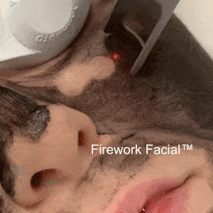 Firework Facial animation