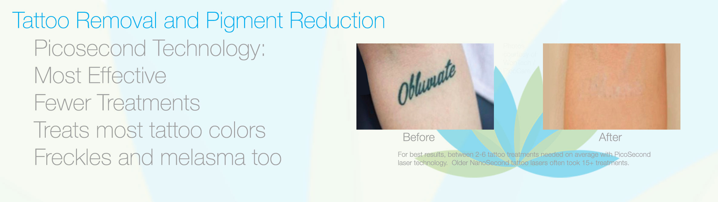 Laser Tattoo Removal and Laser Pigment Reduction at Bravia Dermatology